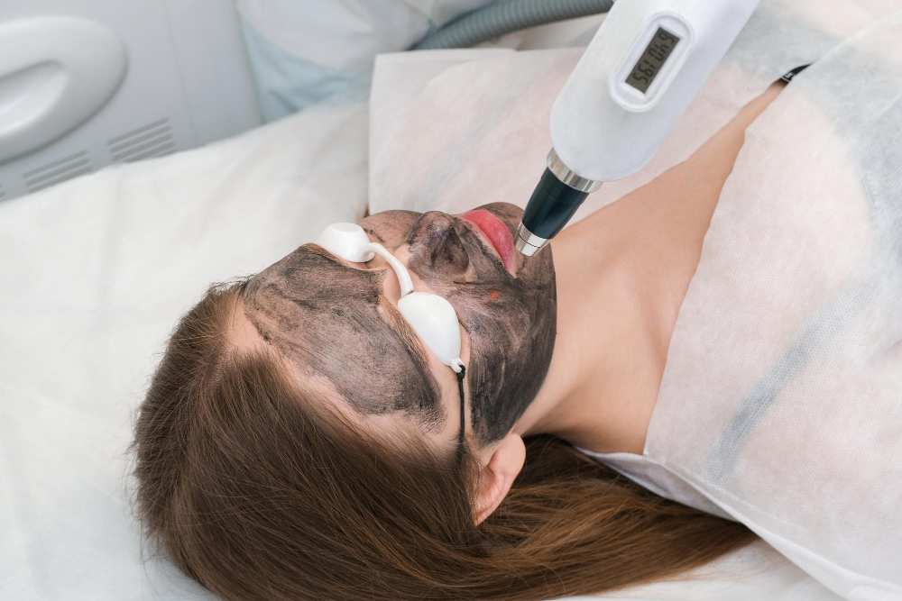 Laser Facial Peel Treatment
