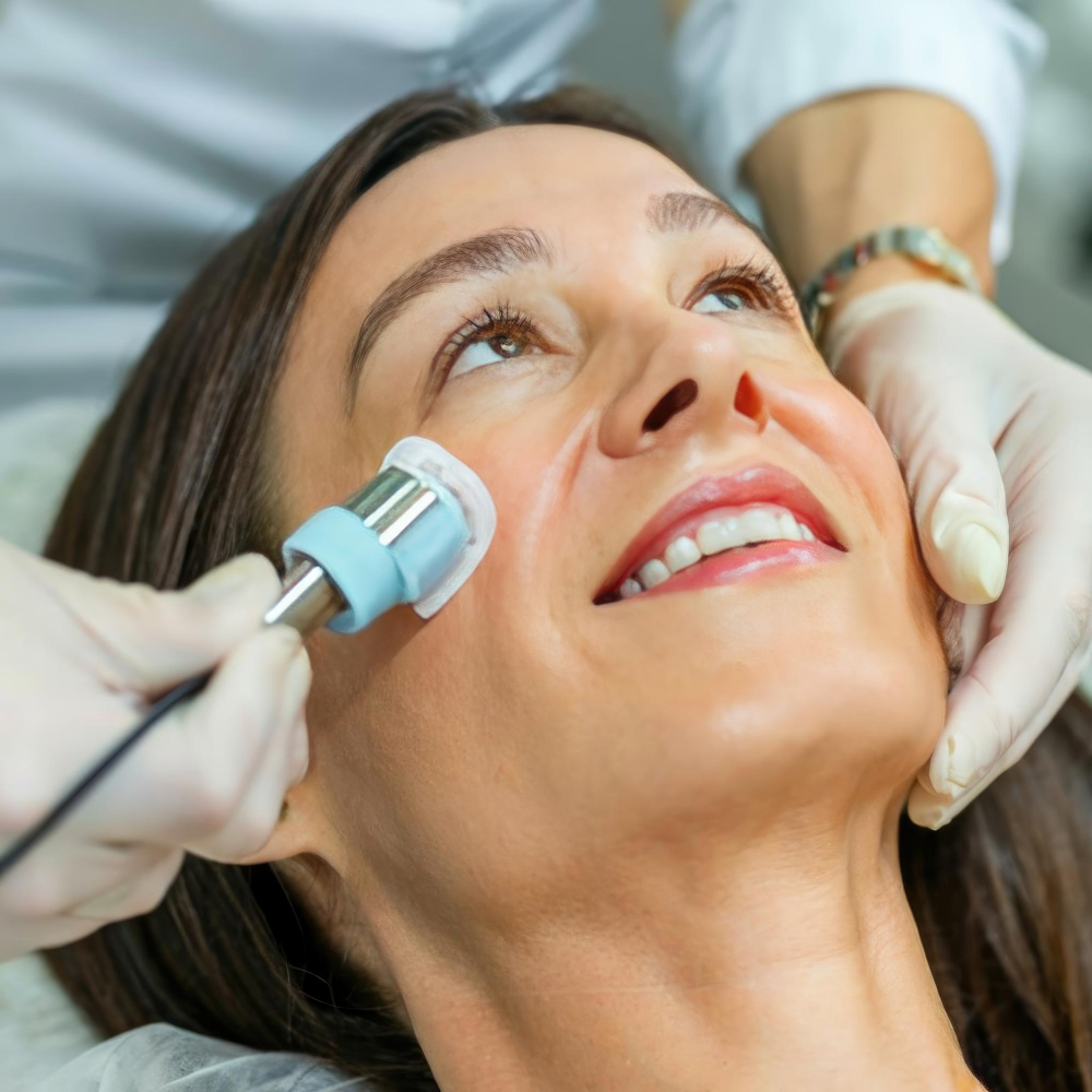 Smoothliftin - Intraoral Tightening