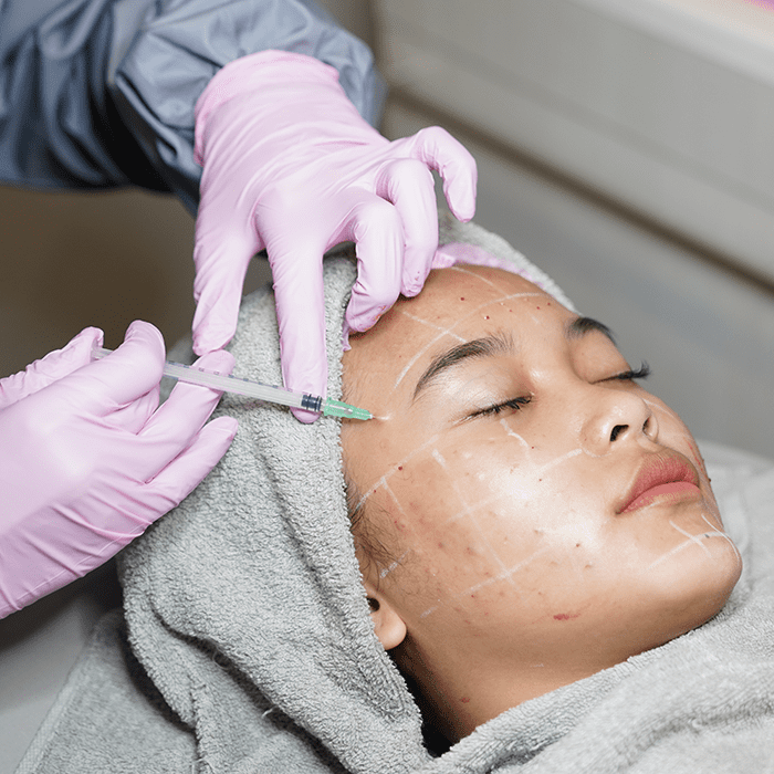  NCTF Skin Booster Injections