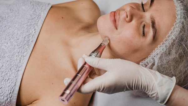 Skin Rejuvenation Facial with Microneedling Treatment