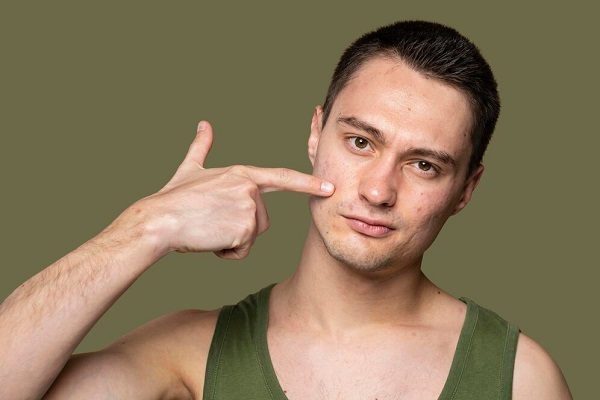 Acne & Acne Scar Treatments in Pickering, ON By by Vitaluxe Medi Spa