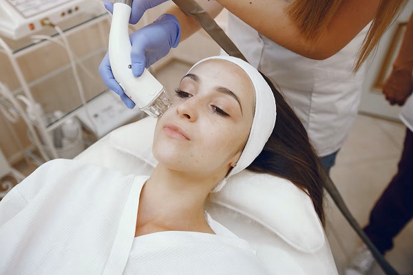 Microlaser Peel Treatment in Pickering, ON by Vitaluxe Medi Spa
